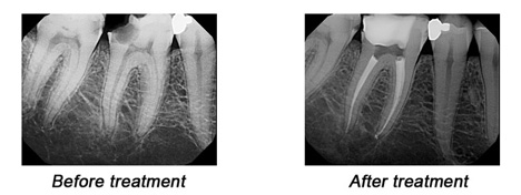 Digital Xray