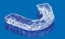 Occlusal Bite Guards