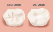 Preventative sealants