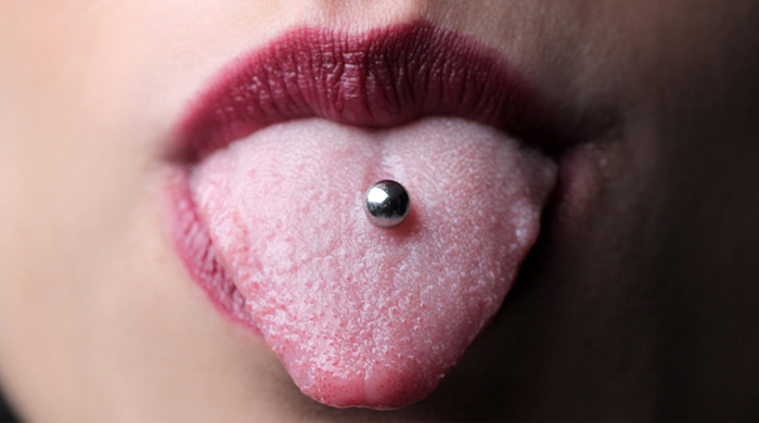 3. Oral Piercing Infection