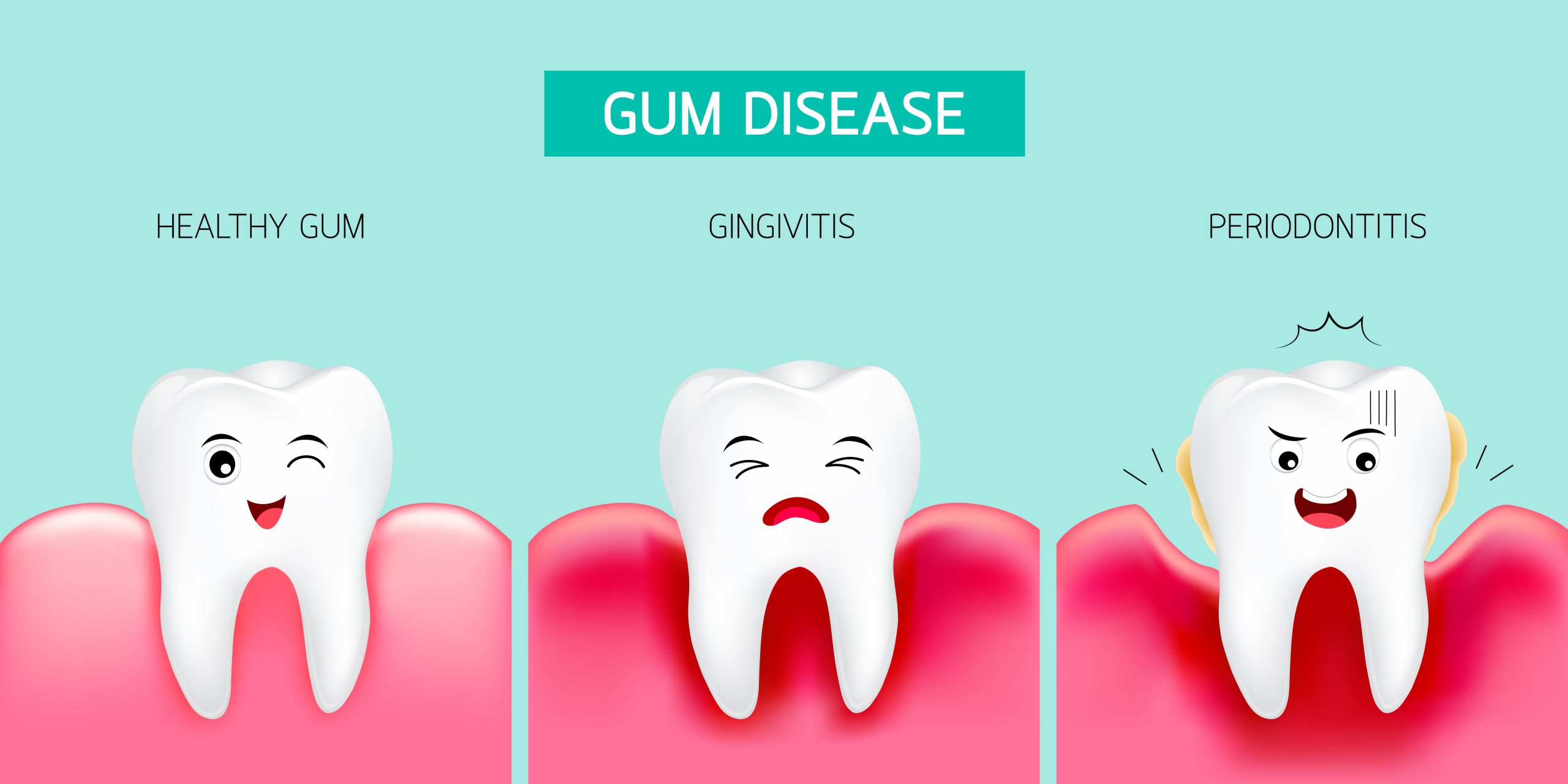 Gum Disease Awareness